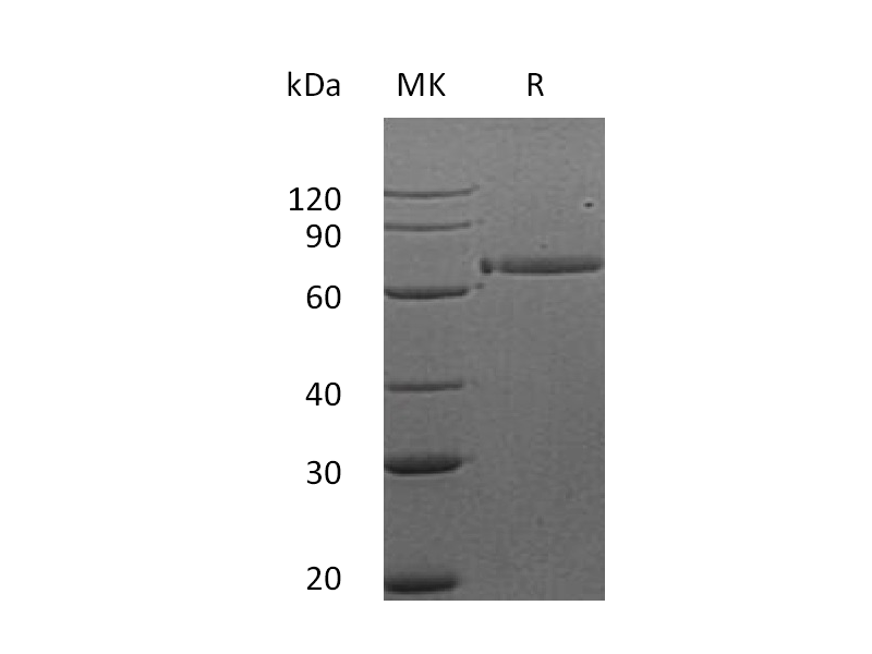 Recombinant Human HER3 (312AA,C-Fc)