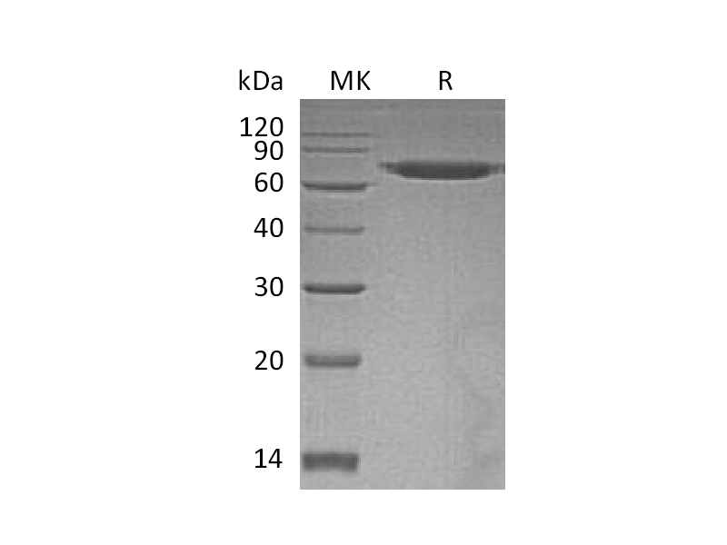 Recombinant Human ERO1L (C-6His)