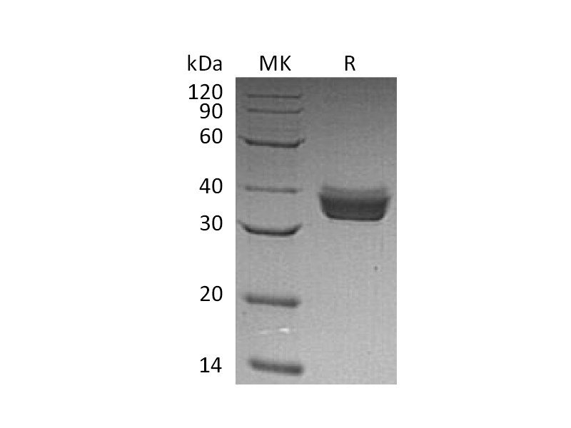 Recombinant Human ERP27 (C-6His)