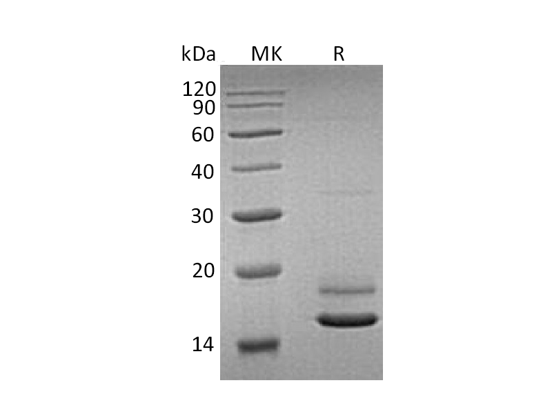Recombinant Human ERMAP (C-6His)