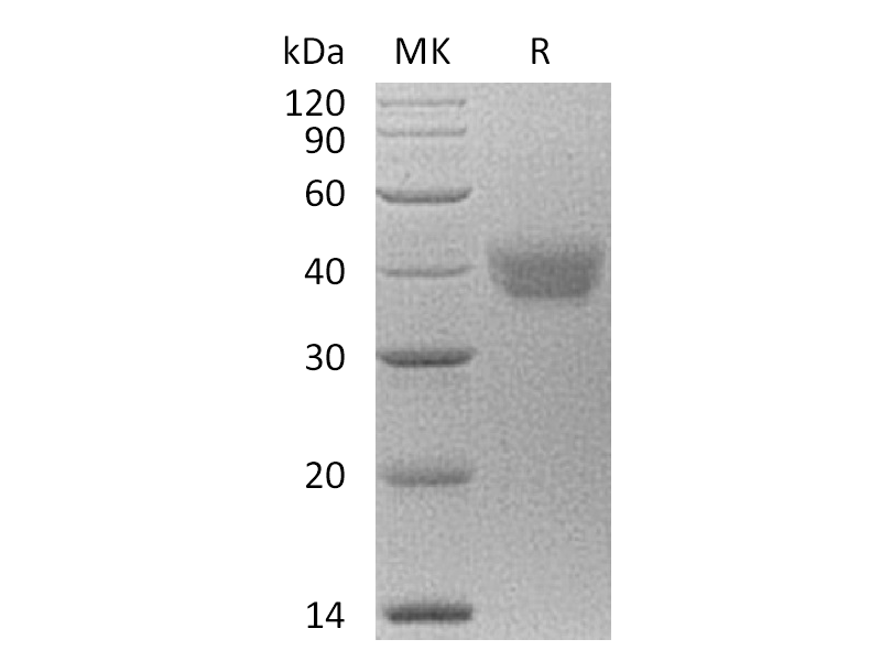 Recombinant Human ESAM (C-6His)