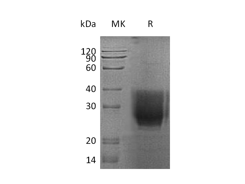 Recombinant Human EMMPRIN (C-6His)