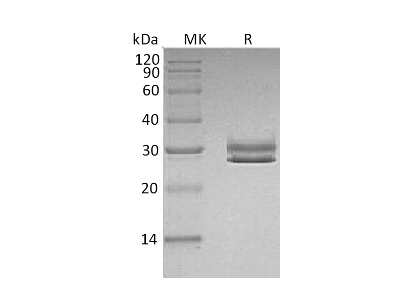 Recombinant Human JAM-A (C-6His)