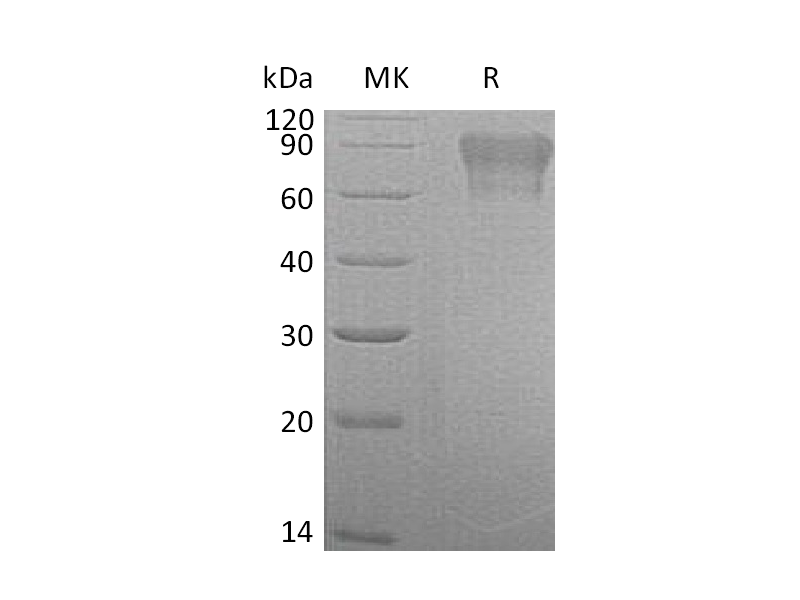 Recombinant Human Factor IX (C-6His)