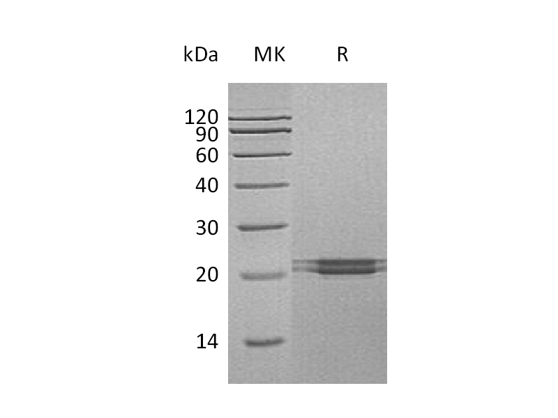 Recombinant Human FAM3C (C-6His)