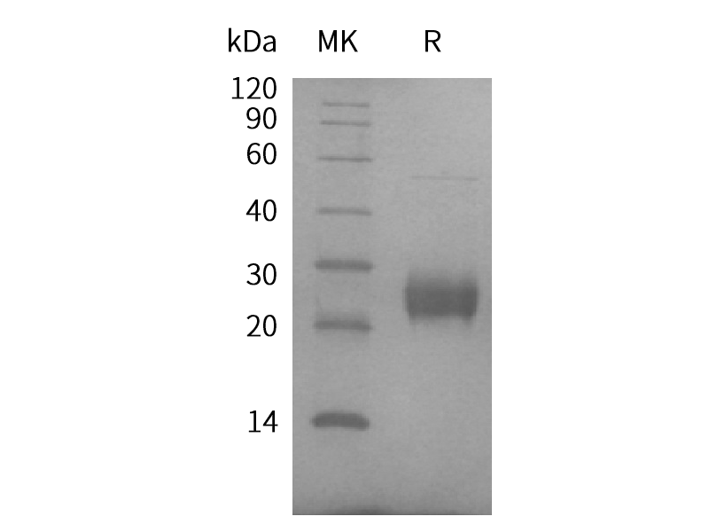 Recombinant Human FAM3D (C-6His)