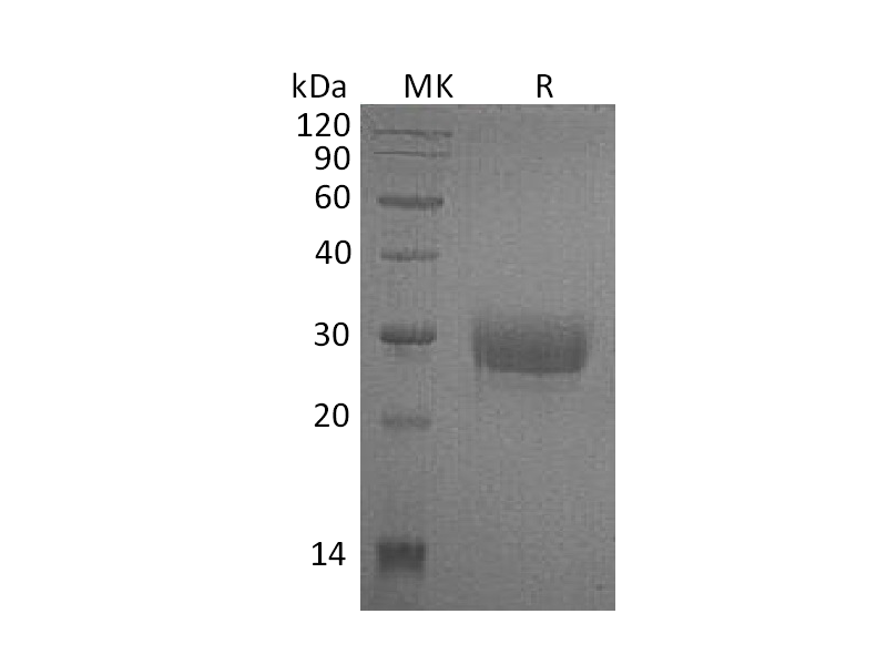 Recombinant Human CD32a (H167,C-6His)