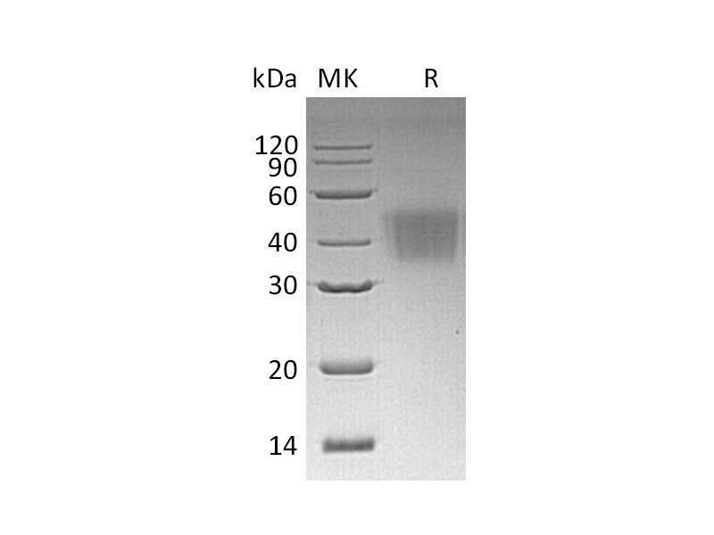 Recombinant Human CD16a (F176,C-6His)