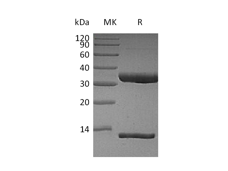 Recombinant Human FcRn Heterodimer (C-6His)
