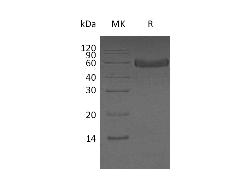 Recombinant Human Fetuin A (C-6His)