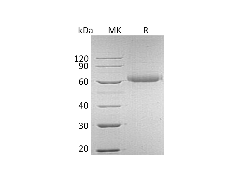 Recombinant Human FGFRL1 (C-6His)