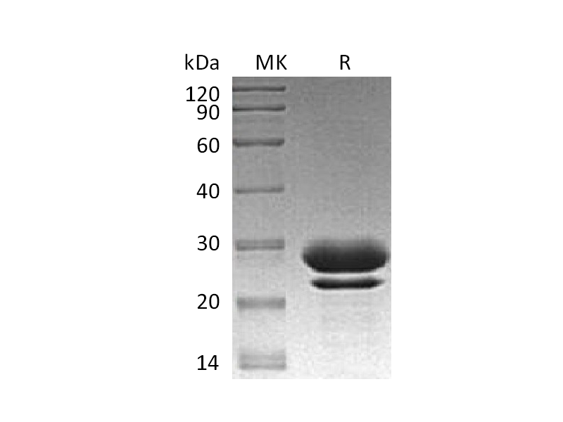 Recombinant Human FKBP7 (C-6His)