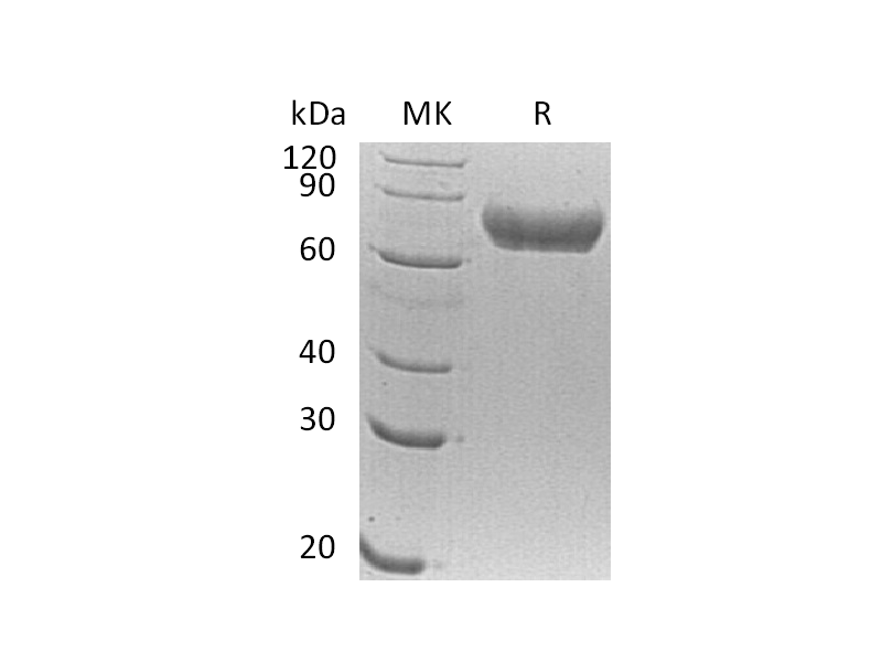 Recombinant Human FLRT1 (C-6His)