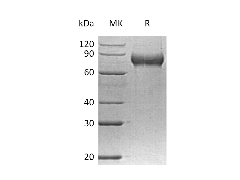 Recombinant Human FLRT2 (C-6His)