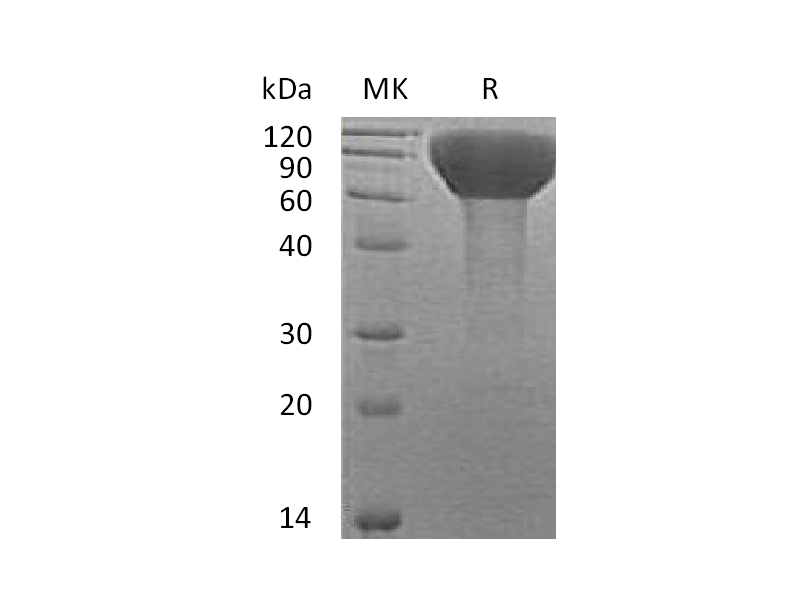 Recombinant Human FLRT3 (C-6His)