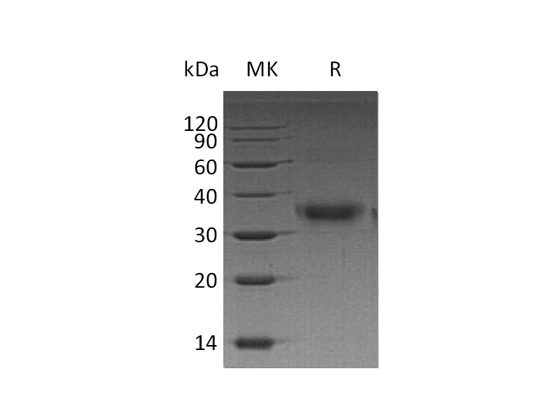 Recombinant Human FOLR1 (C-6His)