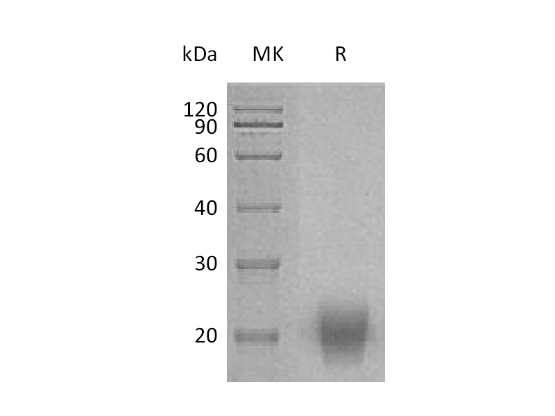 Recombinant Human FSH (C-Flag,C-6His)