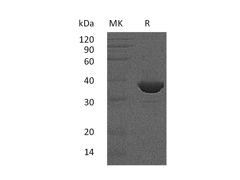 Recombinant Human FBPase1 (C-6His)