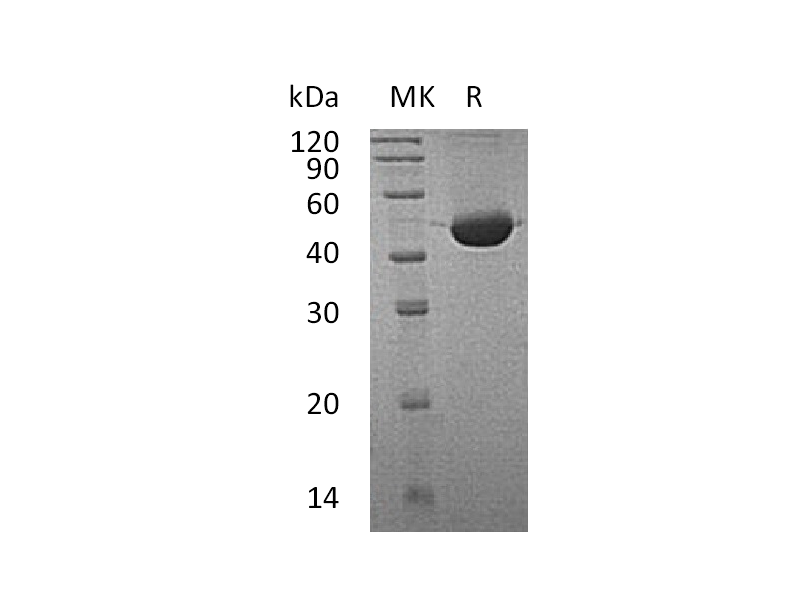 Recombinant Human FAH (C-6His)