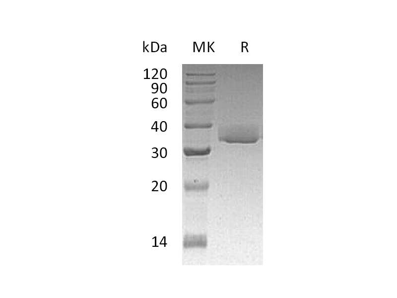 Recombinant Human LGALS3 (C-6His)
