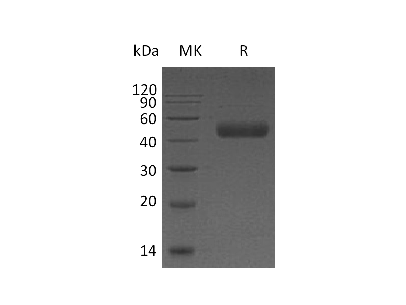 Recombinant Human Galectin 9 (C-6His)