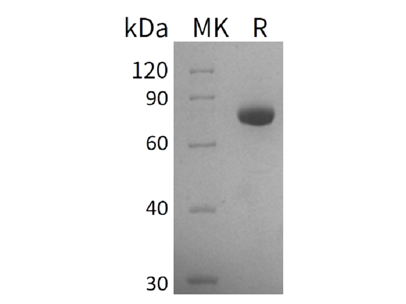 Recombinant Human GALNT3 (C-6His)