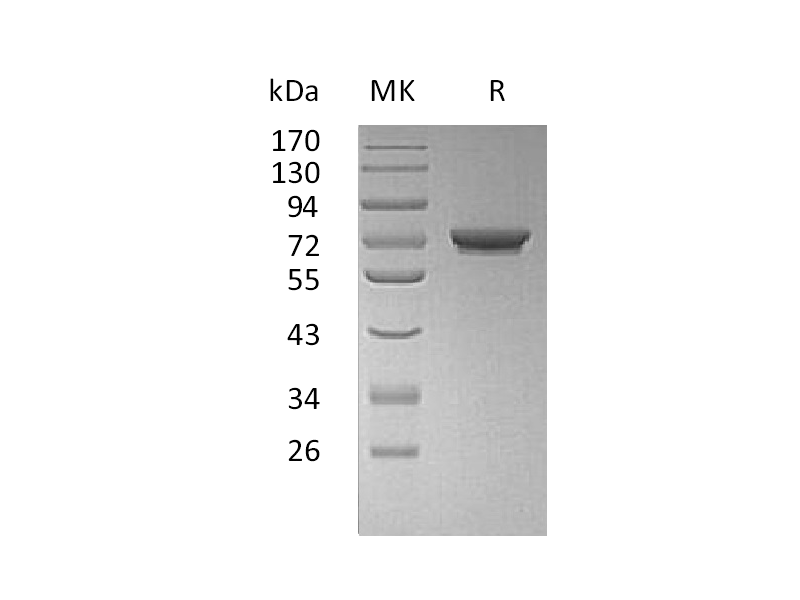 Recombinant Human GALNT7 (C-6His)