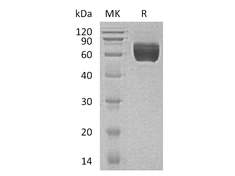 Recombinant Human GALNTL1 (C-6His)