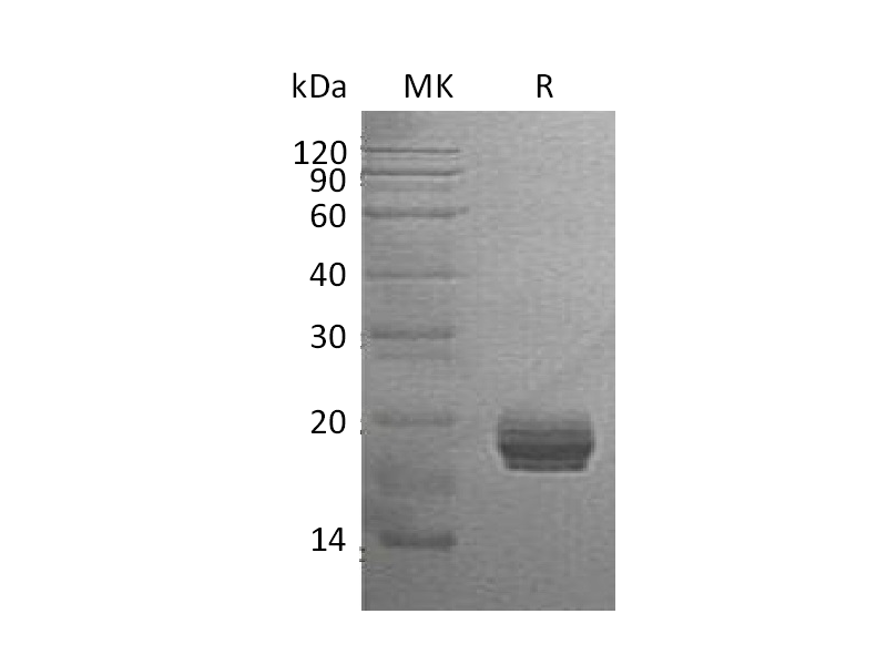 Recombinant Human GM2A (C-6His)