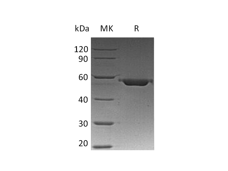 Recombinant Human VDB (C-6His)