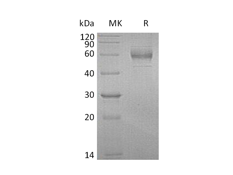 Recombinant Human GFRA1 (C-6His)