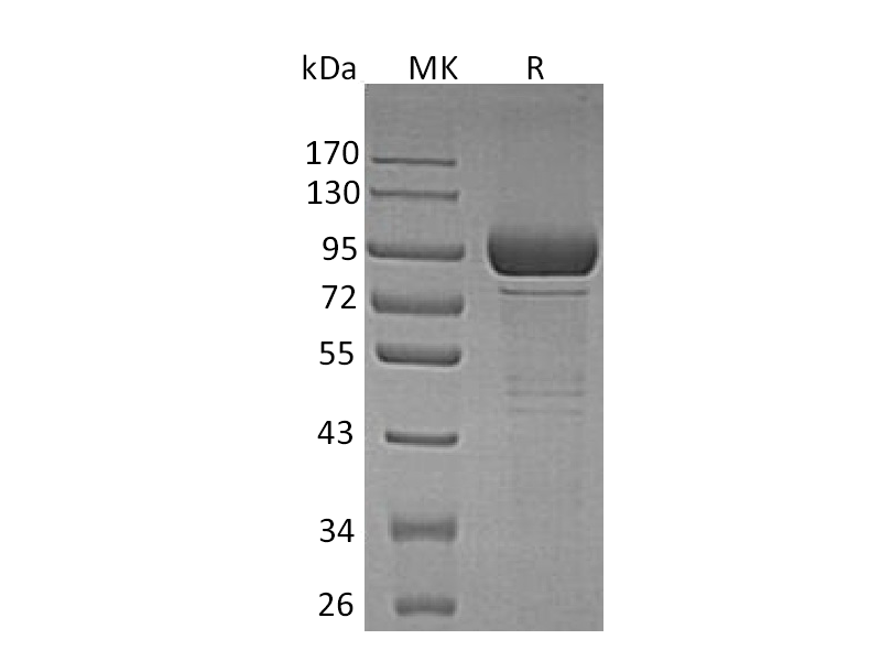 Recombinant Human GLB1 (C-6His)