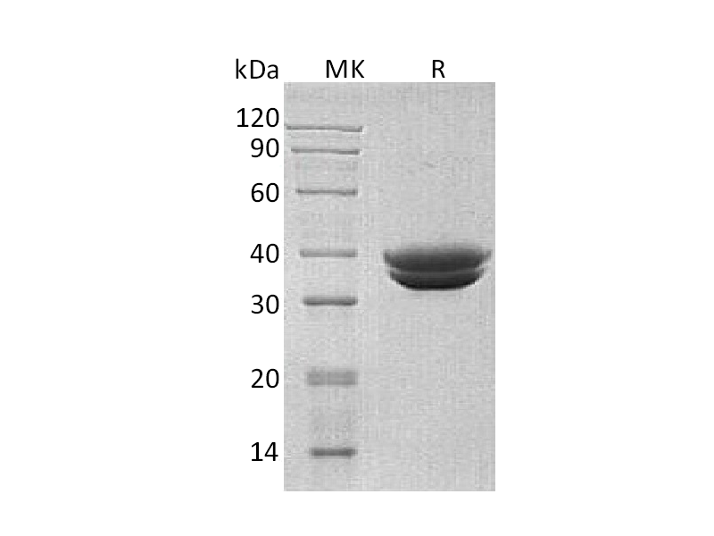 Recombinant Human GPA33 (C-6His)