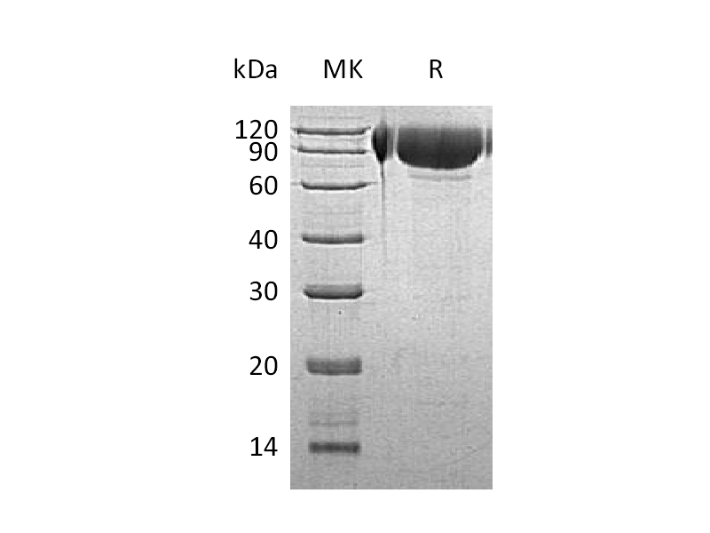 Recombinant Human GNS (C-6His)