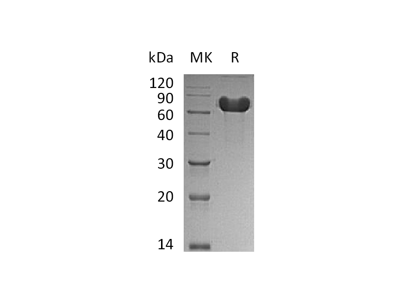 Recombinant Human GOLM1 (C-6His)