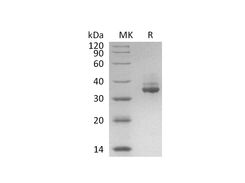 Recombinant Human GPD1 (C-6His)