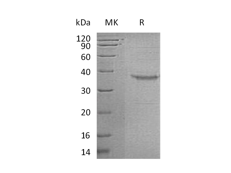 Recombinant Human GHRH (C-Fc)