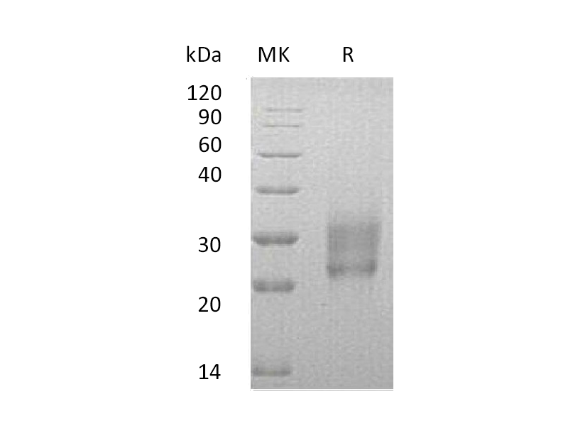 Recombinant Human HAI-2 (C-6His)