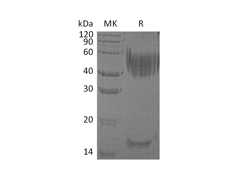 Recombinant Human Haptoglobin (C-6His)