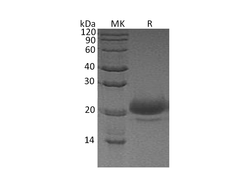 Recombinant Human WFDC2 (C-6His)