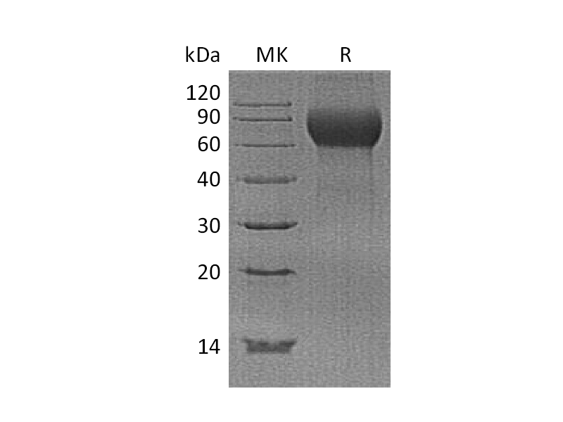 Recombinant Human Hemopexin (C-6His)