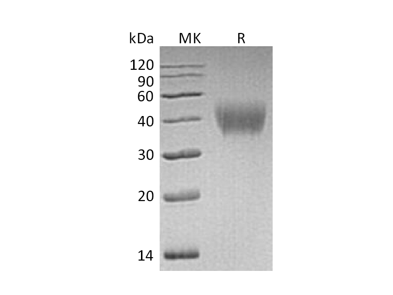 Recombinant Human HepaCAM (C-6His)