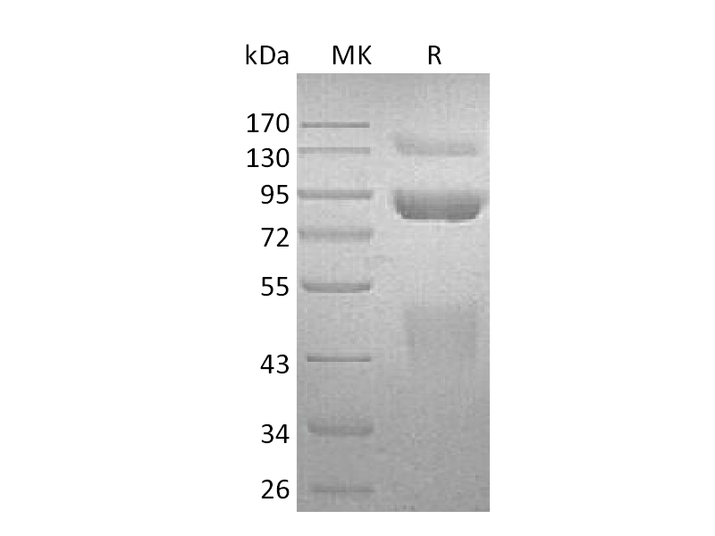 Recombinant Human HGF R (C-6His)