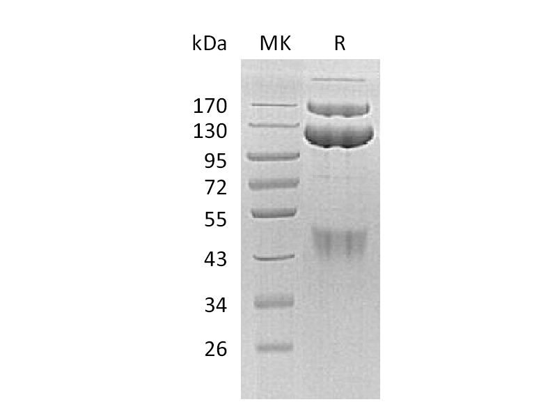 Recombinant Human HGF R (C-Fc)