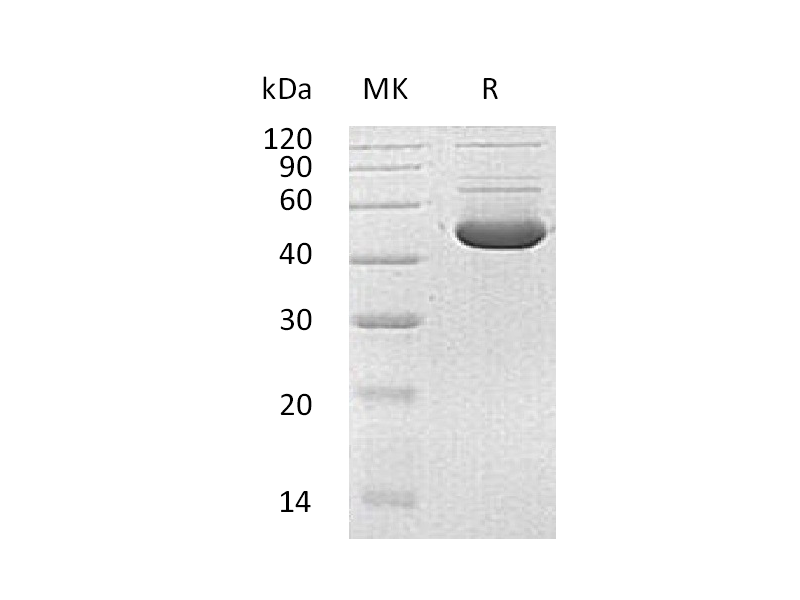 Recombinant Human HMBS (C-6His)