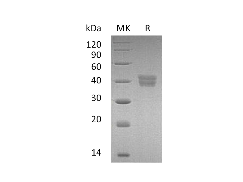 Recombinant Human HTRA2 (C-6His)