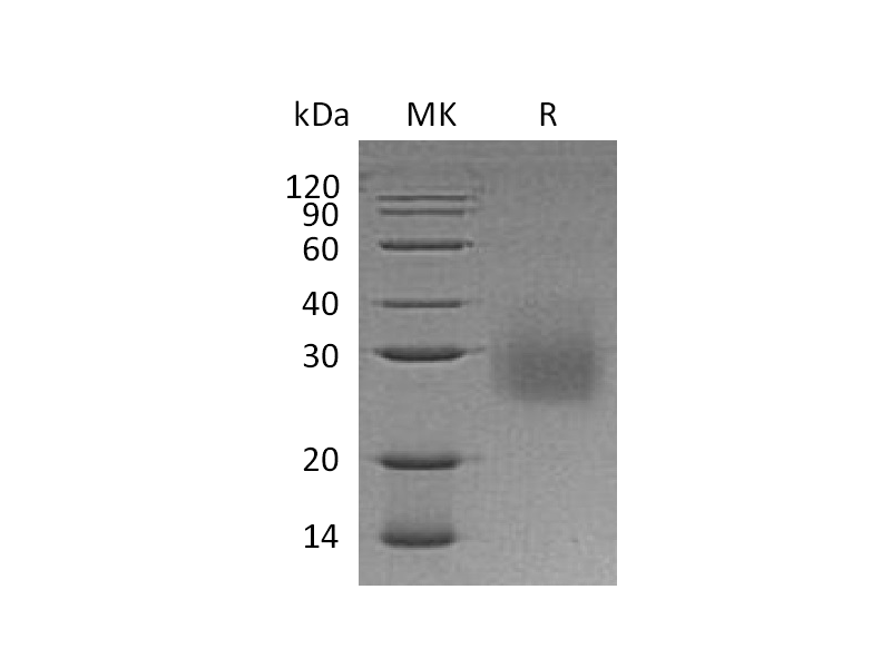 Recombinant Human HVEM (C-6His)