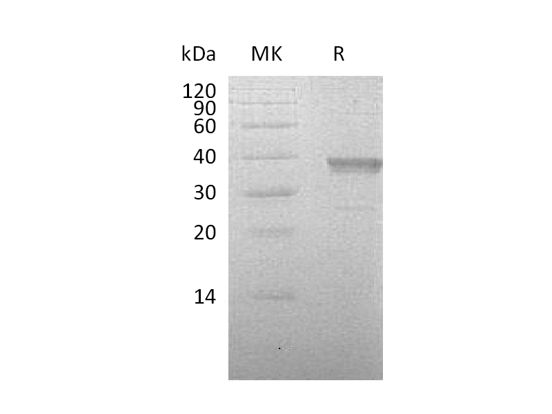 Recombinant Human HABP2 (C-6His)
