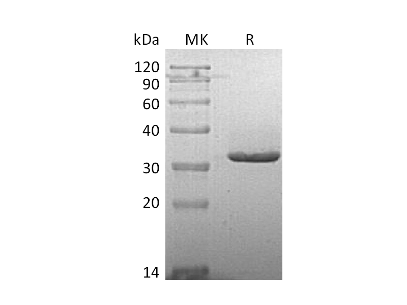 Recombinant Human IgG2 Fc (223AA)
