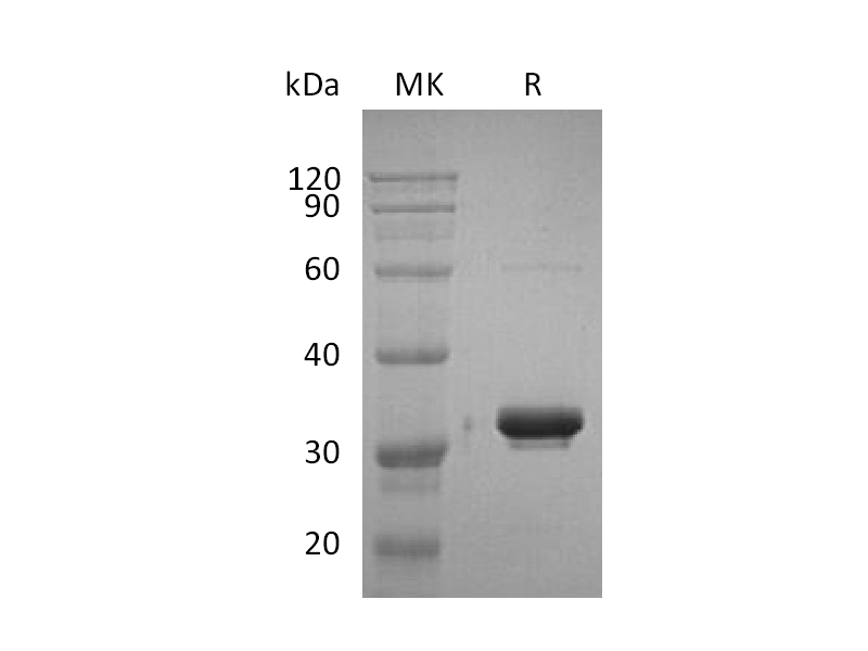 Recombinant Human IgG2 Fc (228AA)